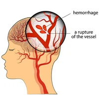 Neuro_lp